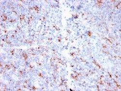S100A8/A9 Antibody (MAC3157R) - Azide and BSA Free, Novus Biologicals 100